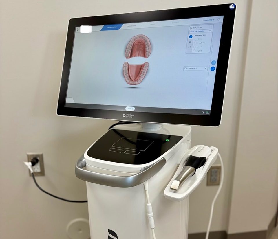 Digital scanner used when creating dentures and partials